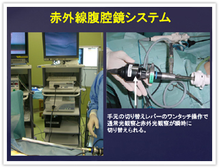 赤外線腹腔鏡システム