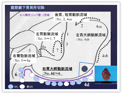 図．腹腔鏡下胃局所切除