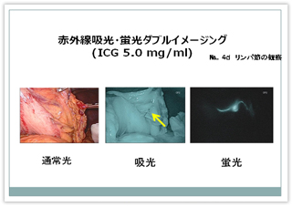 通常光と赤外線光２種類の画像比較写真