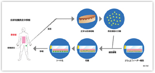 自家培養表皮の移植