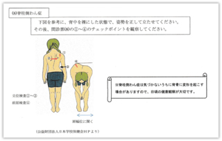 図版５. 問診票で問われる５つの動作項目と脊柱側弯症のチェック図