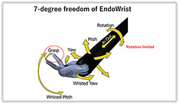 ロボットアームの軸構成